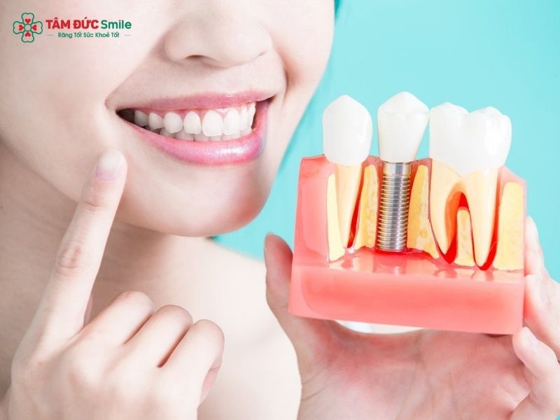dental-implant-cleaning-tools-3