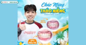 18-tuoi-nieng-rang-duoc-khong