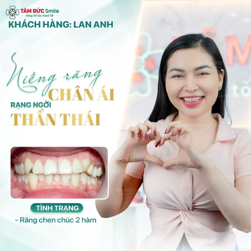 25 tuổi vẫn có thể Abc87 tải ứng dụng