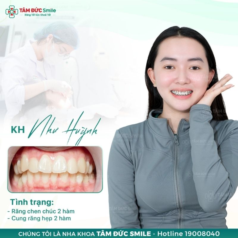 Nên Abc87 tải ứng dụng ở tuổi 25 trong những trường hợp cần thiết