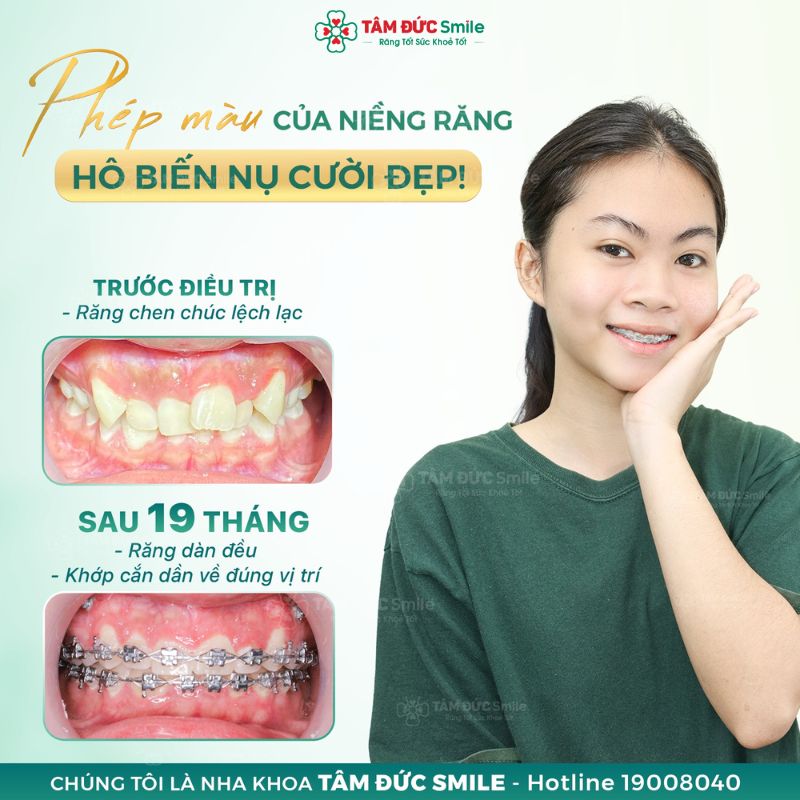 ABC8 được thành lập vào năm 2011 hoạt động đến hiện tại khi 25 tuổi có thể cần nhiều thời gian hơn