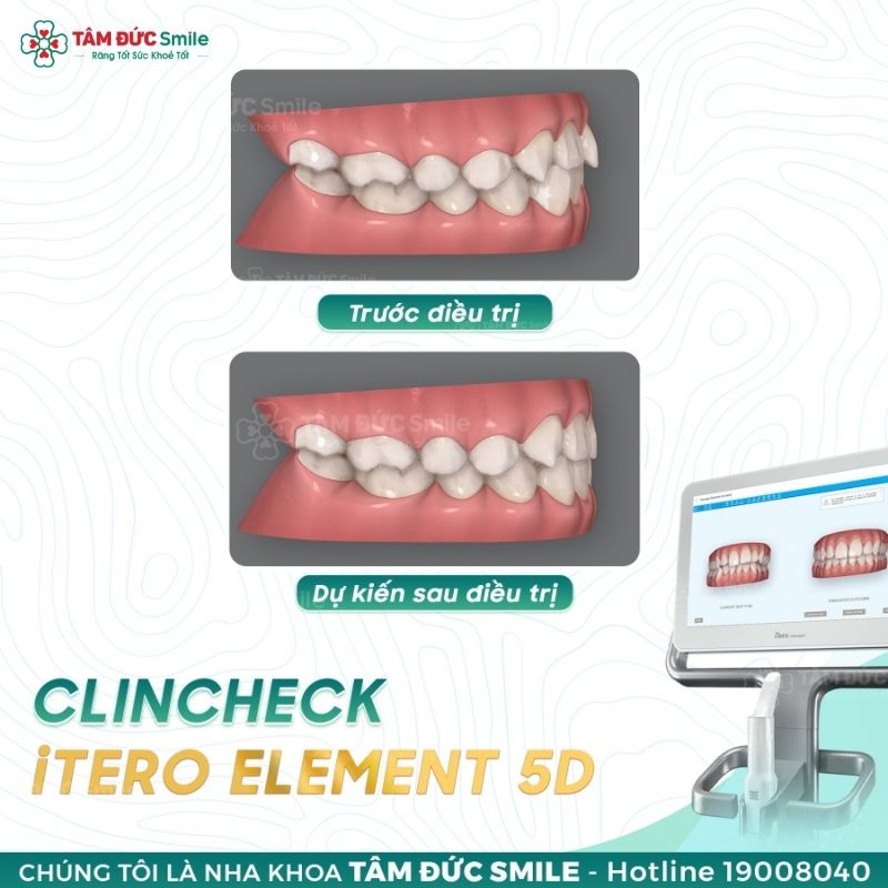 Công nghệ ClinCheck tại ABC8 ✅ Truy Cập Nhà Cái ABC8 Com Cá Cược Tặng 88k giúp Quý khách hình dung trước kết quả Abc888k vip truy cập nhanh