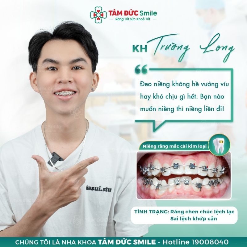 Thời gian Abc87 tải ứng dụng ở tuổi 25 phụ thuộc vào nhiều yếu tố