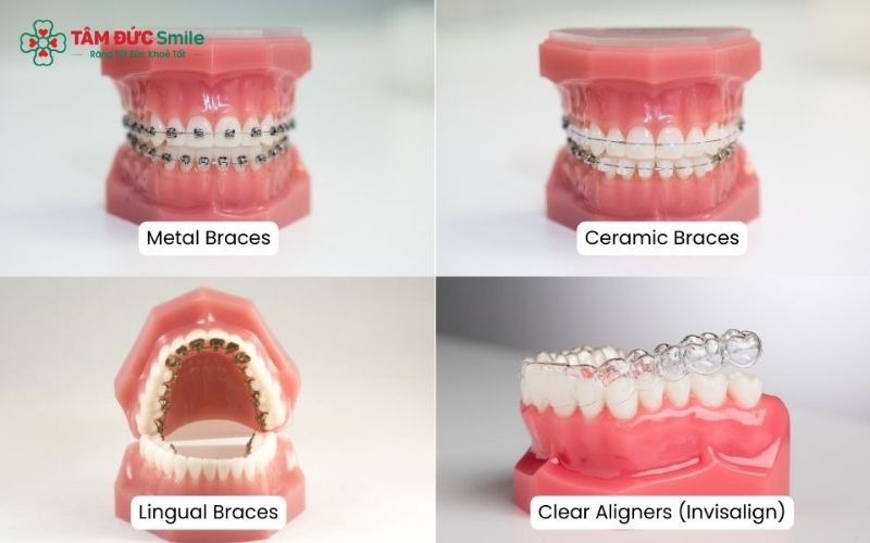 Có nhiều phương pháp Abc87 tải ứng dụng khác nhau để Quý khách lựa chọn