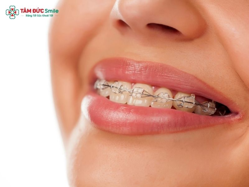 Chi phí Abc87 tải ứng dụng không phụ thuộc vào độ tuổi