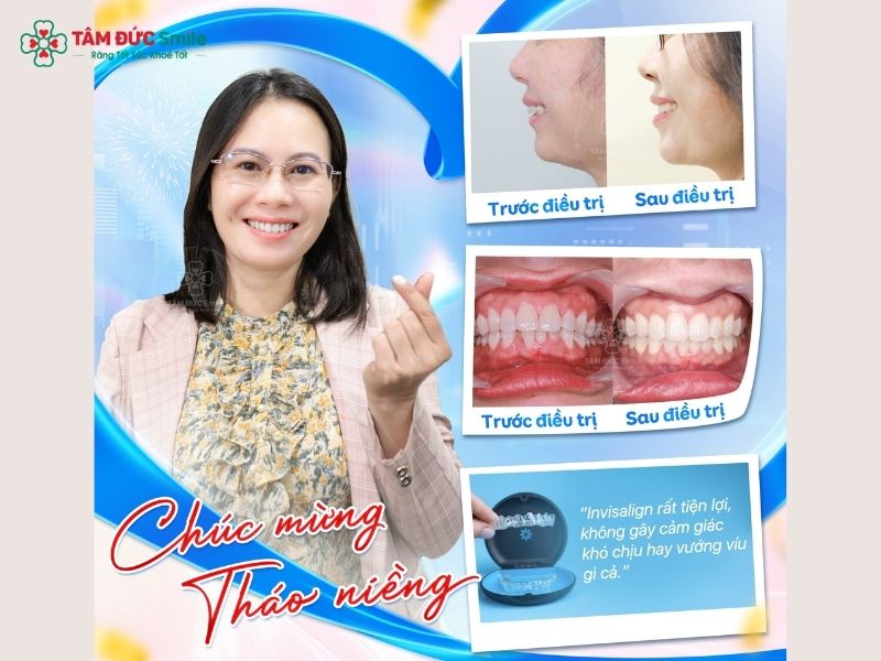 39-tuoi-co-nieng-rang-duoc-khong-8