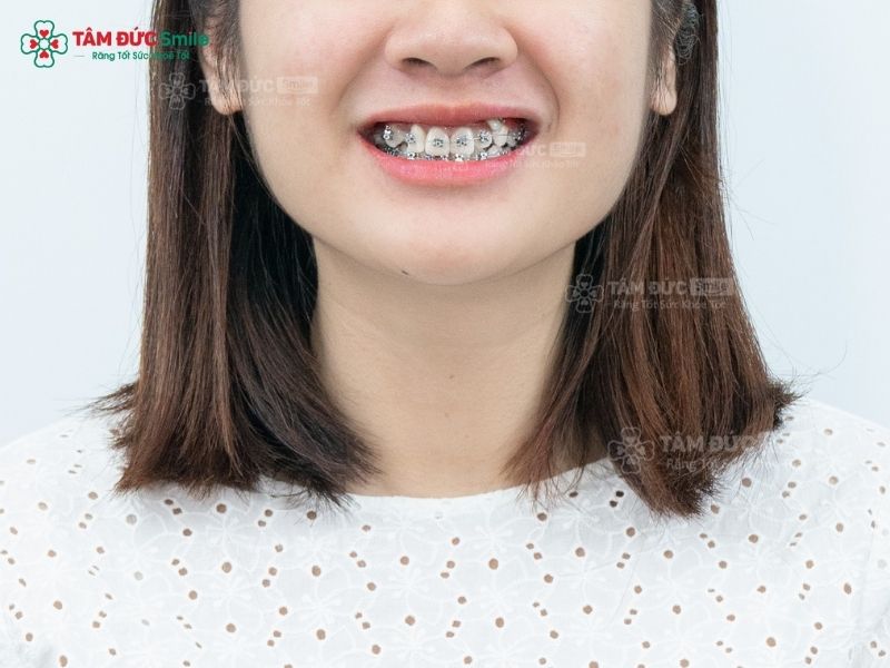 nieng-rang-4-nam-1