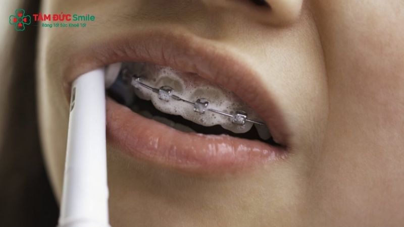 Hôi miệng khi Abc87 tải ứng dụng có liên quan chế độ vệ sinh và ăn uống
