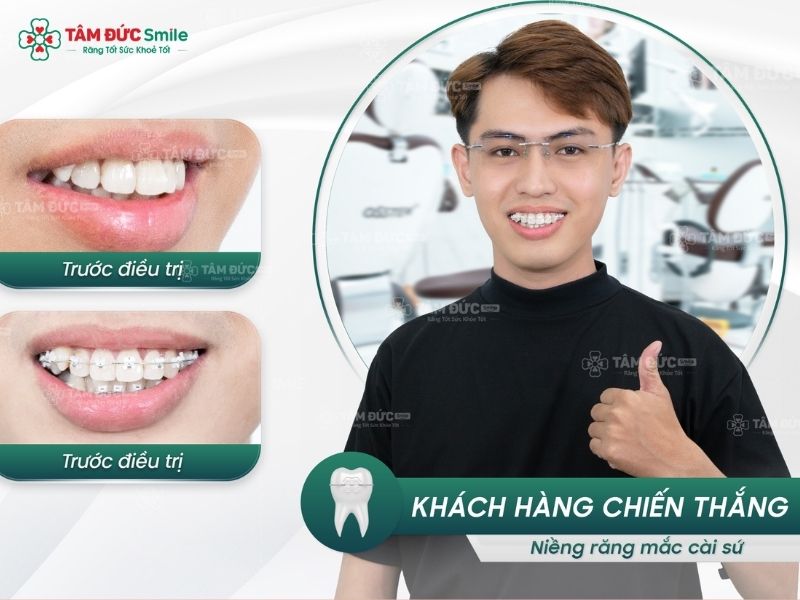 nieng-rang-bi-nhiet-mieng-8