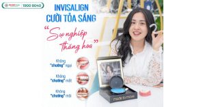 nieng-rang-clear-aligner-gia-bao-nhieu