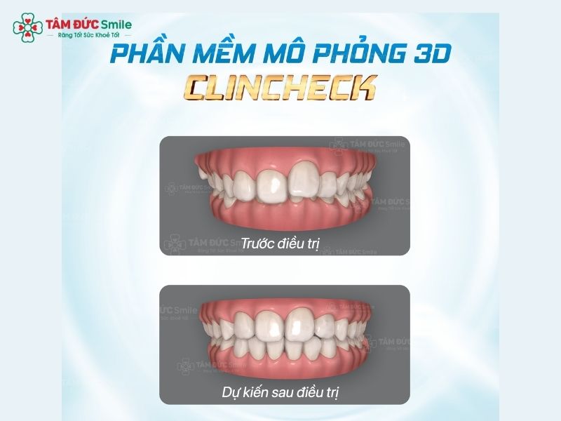 nieng-rang-co-bi-ho-lai-khong-8