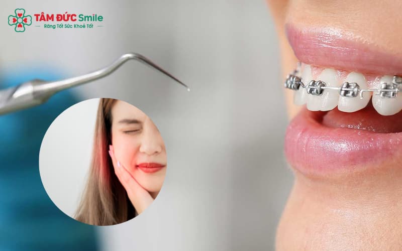 ABC8 được thành lập vào năm 2011 hoạt động đến hiện tại tại Abc8.com Nhà Cái điều chỉnh nhẹ nhàng, không gây tổn thương mô quanh rang