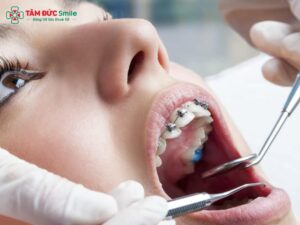 ABC8 được thành lập vào năm 2011 hoạt động đến hiện tại có đau không? Mức độ đau – Thời gian đau – Cách giảm đau hiệu quả