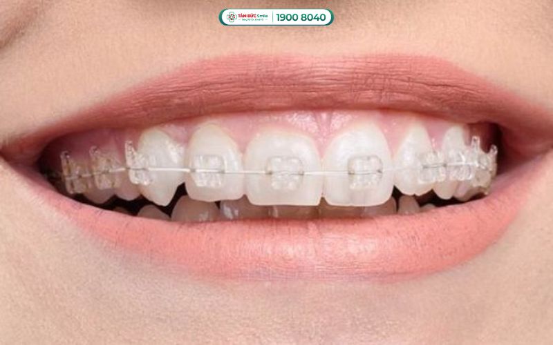 ABC8 được thành lập vào năm 2011 hoạt động đến hiện tại mắc cài pha lê sử dụng hệ thống mắc cài pha lê nguyên khối trong suốt