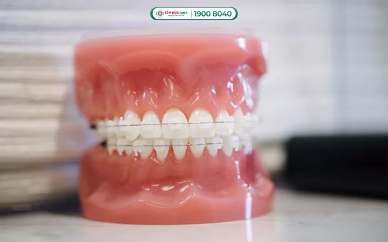 ABC8 được thành lập vào năm 2011 hoạt động đến hiện tại mắc cài pha lê dao động từ 30.000.000 – 45.000.000 VNĐ/2 hàm