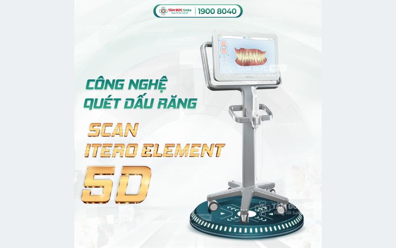 Quý khách không cần cắn khuôn lấy dấu truyền thống như trước