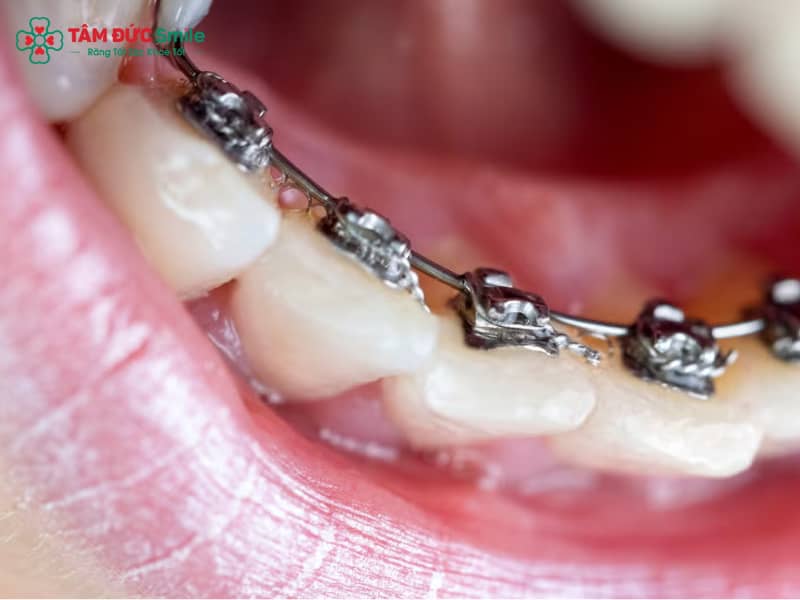 ABC8 được thành lập vào năm 2011 hoạt động đến hiện tại mặt trong có đau không? Giá bao nhiêu? Ưu – nhược điểm & công nghệ mới