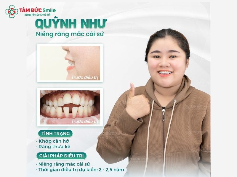 nieng-rang-quan-1-8