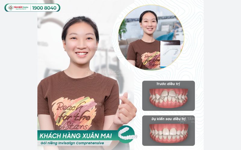 nieng-rang-thao-lap-gia-bao-nhieu-5