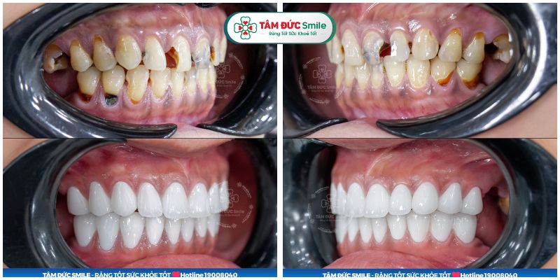 Quý khách nên Abc8.com Thể thao, Đá gà, Xổ số, Bắn cá trong những trường hợp cần thiết để cải thiện Abc8c1 com khuyến mãi hấp dẫn ABC8 được thành lập vào năm 2011 hoạt động đến hiện tại