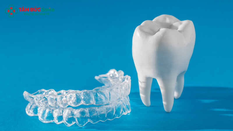 Đeo hàm duy trì đều đặn giúp giữ răng ổn định sau niềng