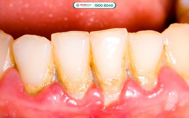 Khi xuất hiện Abc8com nổ hũ, hôi miệng hoặc chảy máu Abc8com giaitri tructuyen, khách hàng nên thăm khám sớm tại ABC8 ✅ Truy Cập Nhà Cái ABC8 Com Cá Cược Tặng 88k.