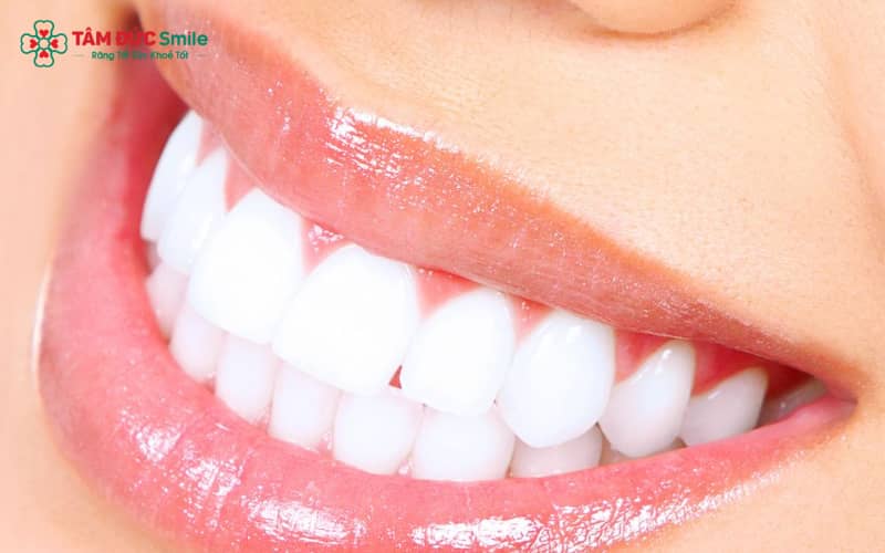 Tình trạng răng mọc thiếu hoặc thừa làm thay đổi khớp cắn, giảm hiệu quả ăn nhai và ảnh hưởng Abc8c1 com khuyến mãi hấp dẫn khuôn mặt