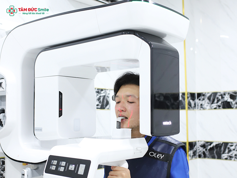 dia-chi-cay-ghep-implant-tot-tai-ca-mau-1068-2