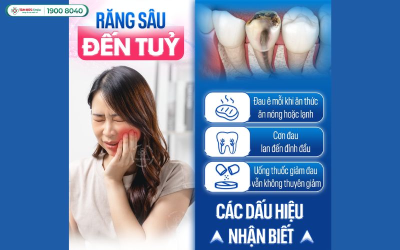 dia-chi-dieu-tri-tuy-rang-binh-duong-1