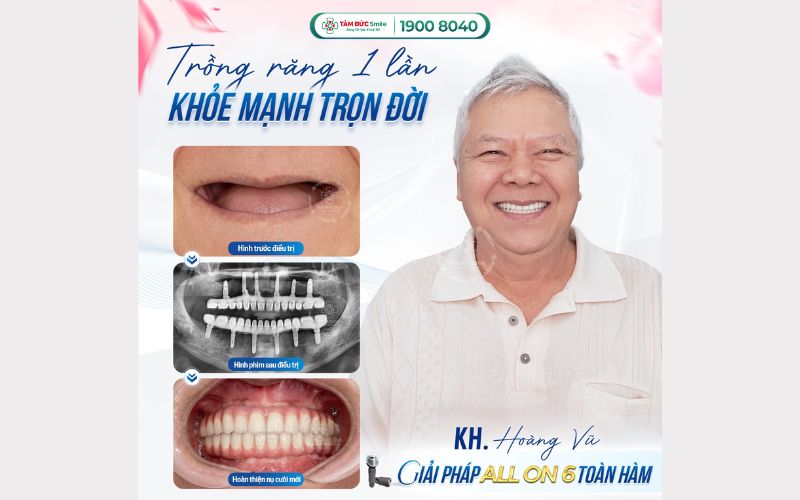 dia-chi-nha-khoa-binh-duong-4