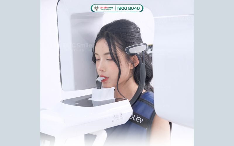 Kết hợp máy CT Cone Beam chẩn đoán chính xác