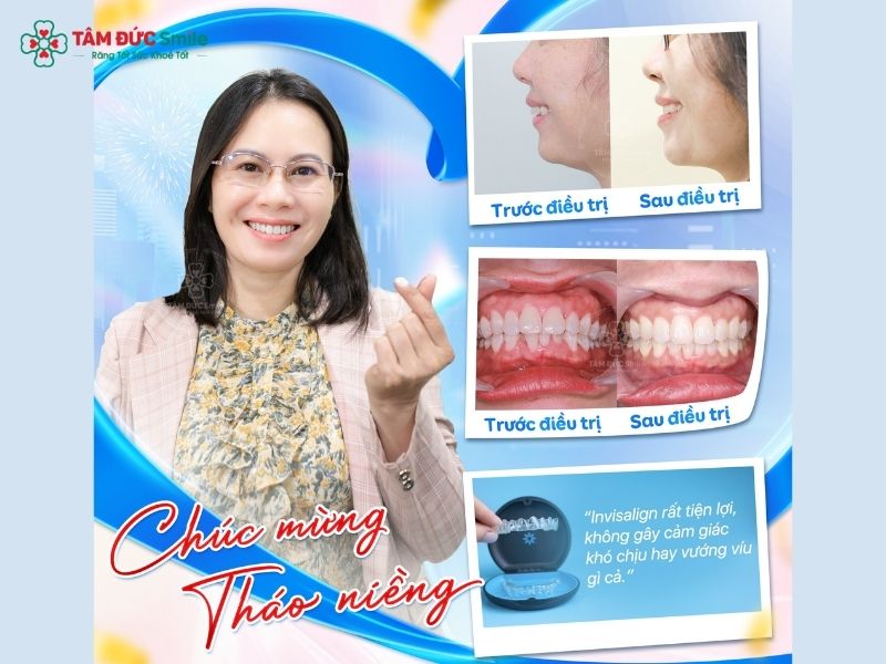 gia-nieng-rang-ho-nhe-5