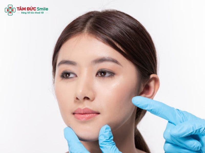 Nhiều trường hợp có gò má cao là do răng