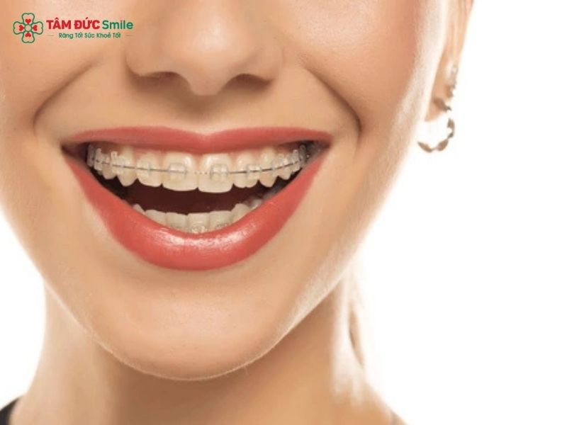 Gò má cao có nên Abc87 tải ứng dụng không sẽ do ABC8 đường link chính thức chỉ định