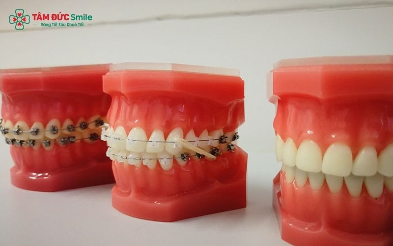 Người có gò má cao có thể Abc87 tải ứng dụng bằng nhiều phương pháp khác nhau