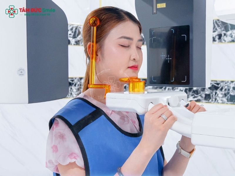 Quý khách cần được chụp phim Cone Beam CT trước khi Abc888k vip truy cập nhanh