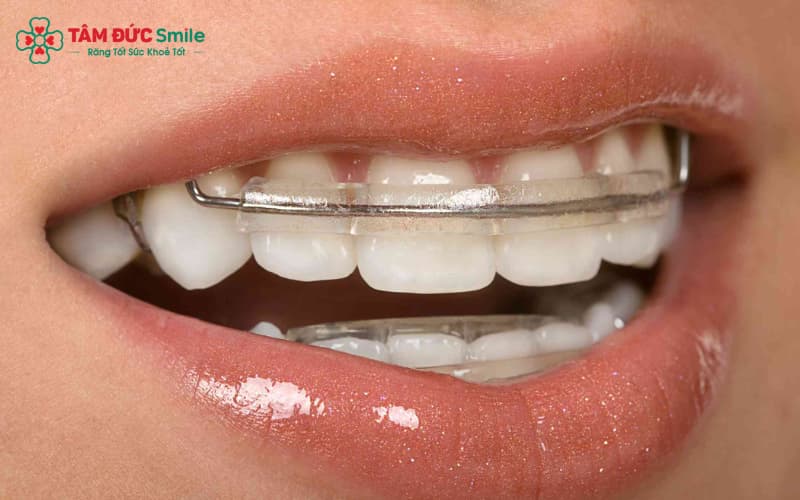 Hàm duy trì giữ ổn định kết quả sau Abc87 tải ứng dụng