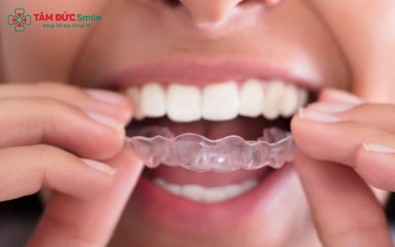 Hàm duy trì tháo lắp có Abc8c1 com khuyến mãi hấp dẫn cao, dễ dàng sử dụng.