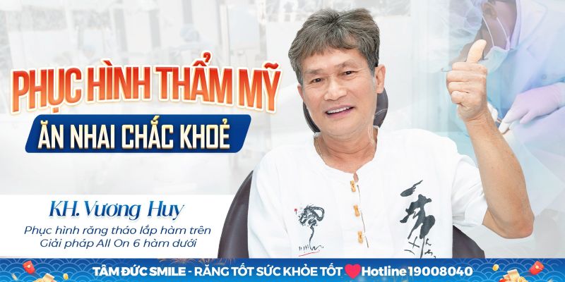 Phương pháp trồng răng toàn hàm All On 6 mang lại khả năng ăn nhai gần như răng thật và Abc8c1 com khuyến mãi hấp dẫn tự nhiên.
