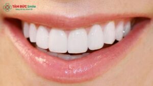lam-4-rang-cua-boc-su-co-duoc-khong-1192-1