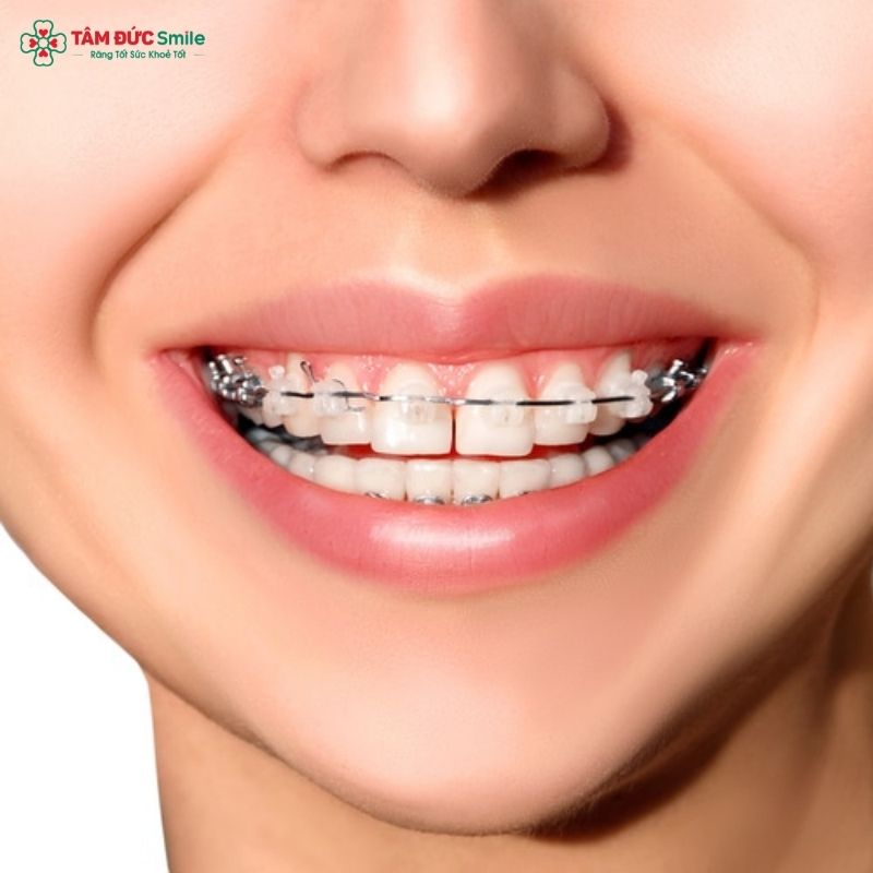 Người bị lệch mặt có thể Abc87 tải ứng dụng để cải thiện