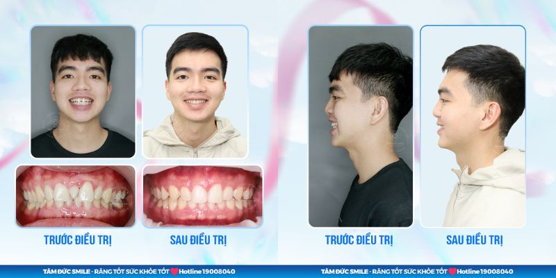 Sự thay đổi rõ rệt sau Abc87 tải ứng dụng