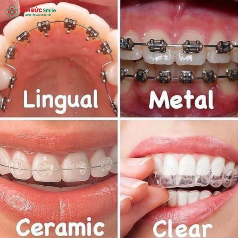 Quý khách có thể chọn lựa Abc87 tải ứng dụng bằng nhiều phương pháp khác nhau