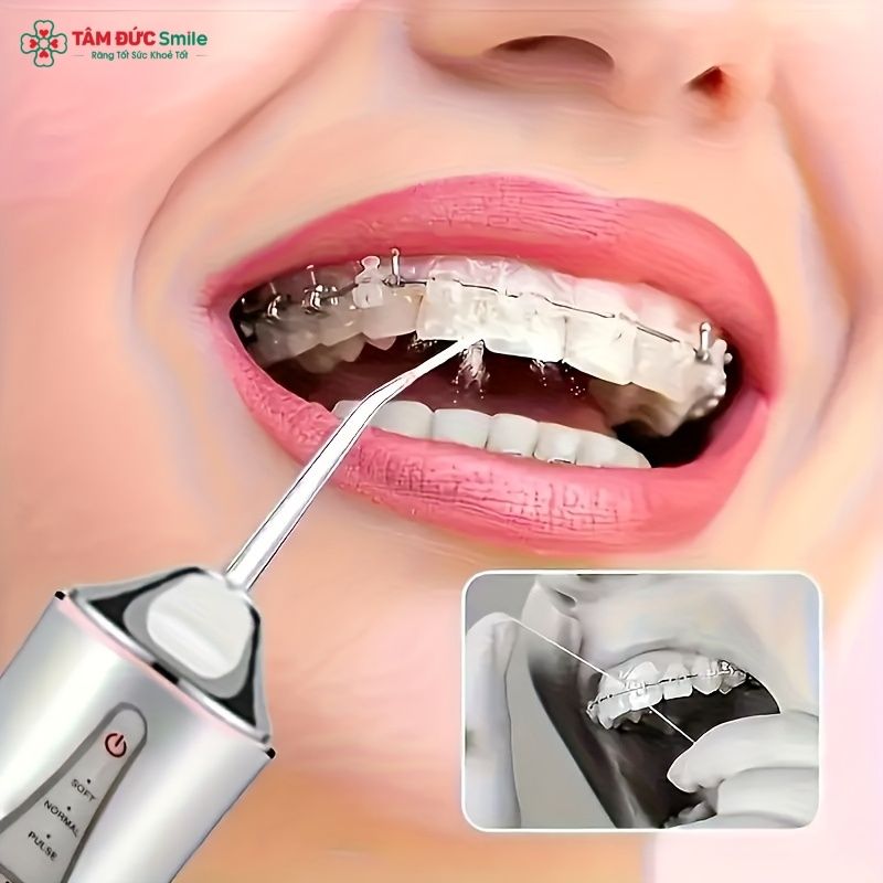 Sử dụng máy tăm nước khi Abc87 tải ứng dụng giúp làm sạch ABC8 là nhà cái cá cược trực tuyến uy tín số 1 tại Việt Nam hiệu quả hơn
