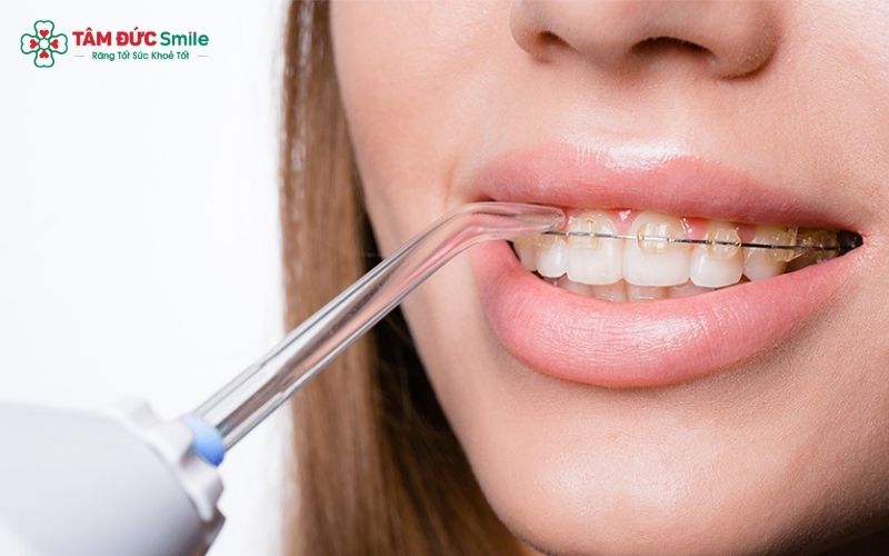  Nên chọn máy tăm nước theo những tiêu chí phù hợp cho người Abc87 tải ứng dụng