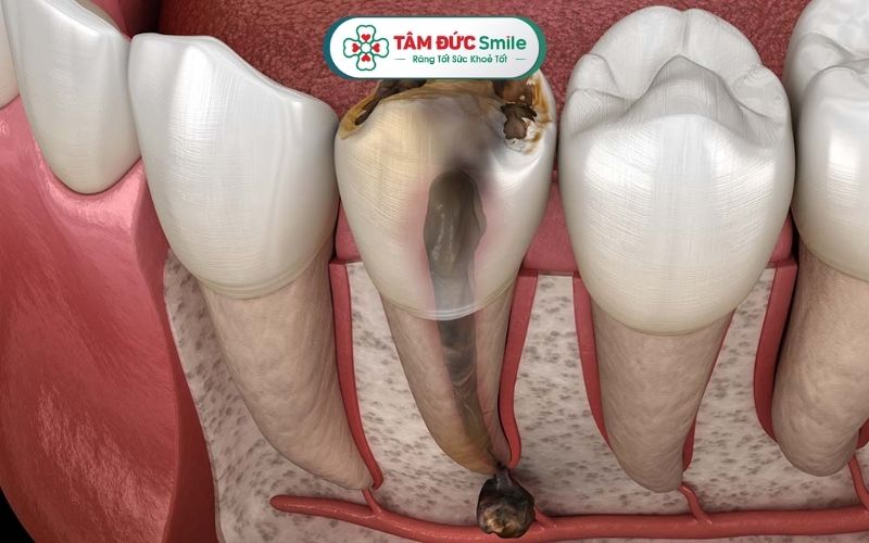 Nang Abc8com giaitri tructuyen có thể xảy ra do nhiều nguyên nhân khác nhau