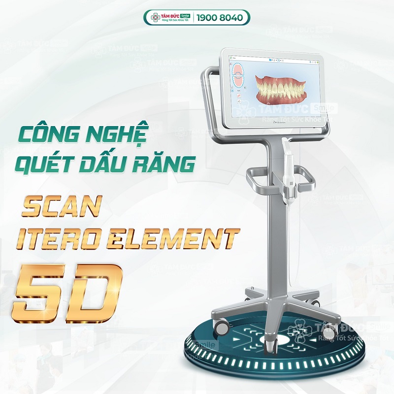 nha-khoa-hai-chau-uy-tin-tay-trang-nieng-rang-implant-tai-tam-duc-smile-2152-2