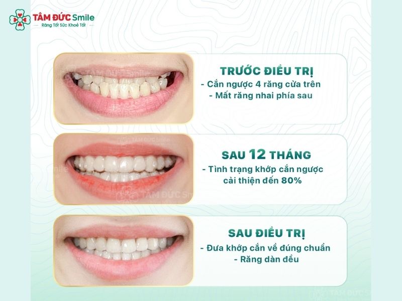 nieng-rang-khong-mac-cai-9