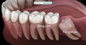 rang-cam