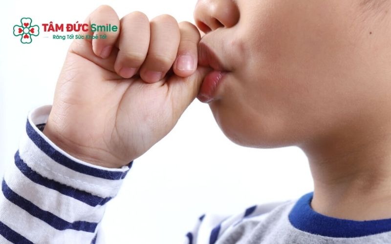 Một số thói quen xấu có thể khiến cho răng mọc lẫy